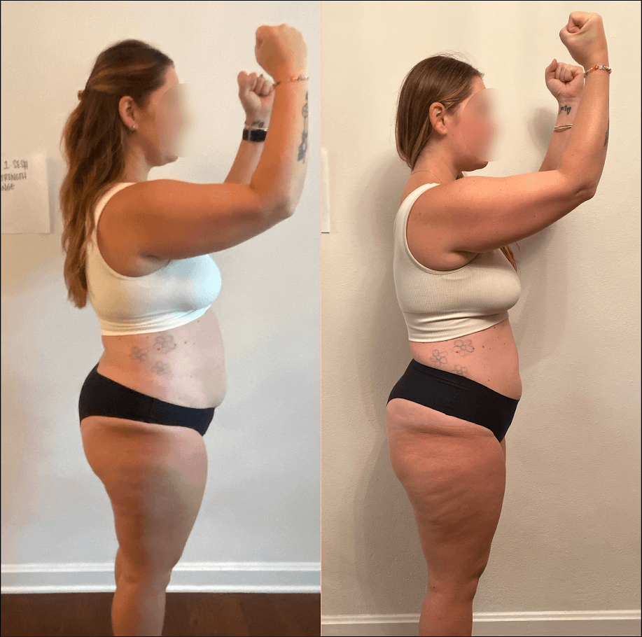 before and after